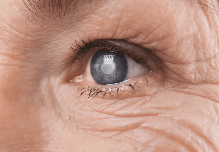 Close up of an eye