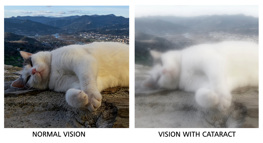 Normal vision compared to vision through cataracts